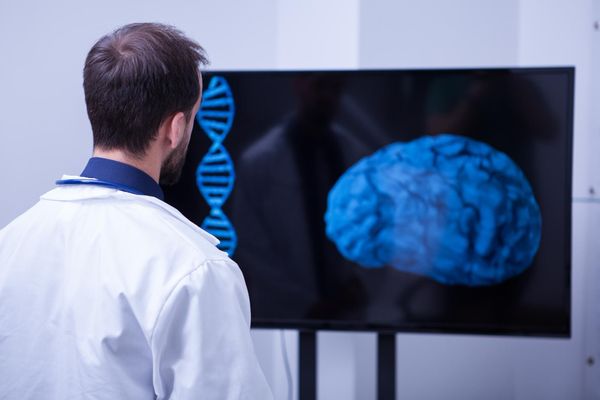 רופא צעיר מפענח סריקת MRI מוח